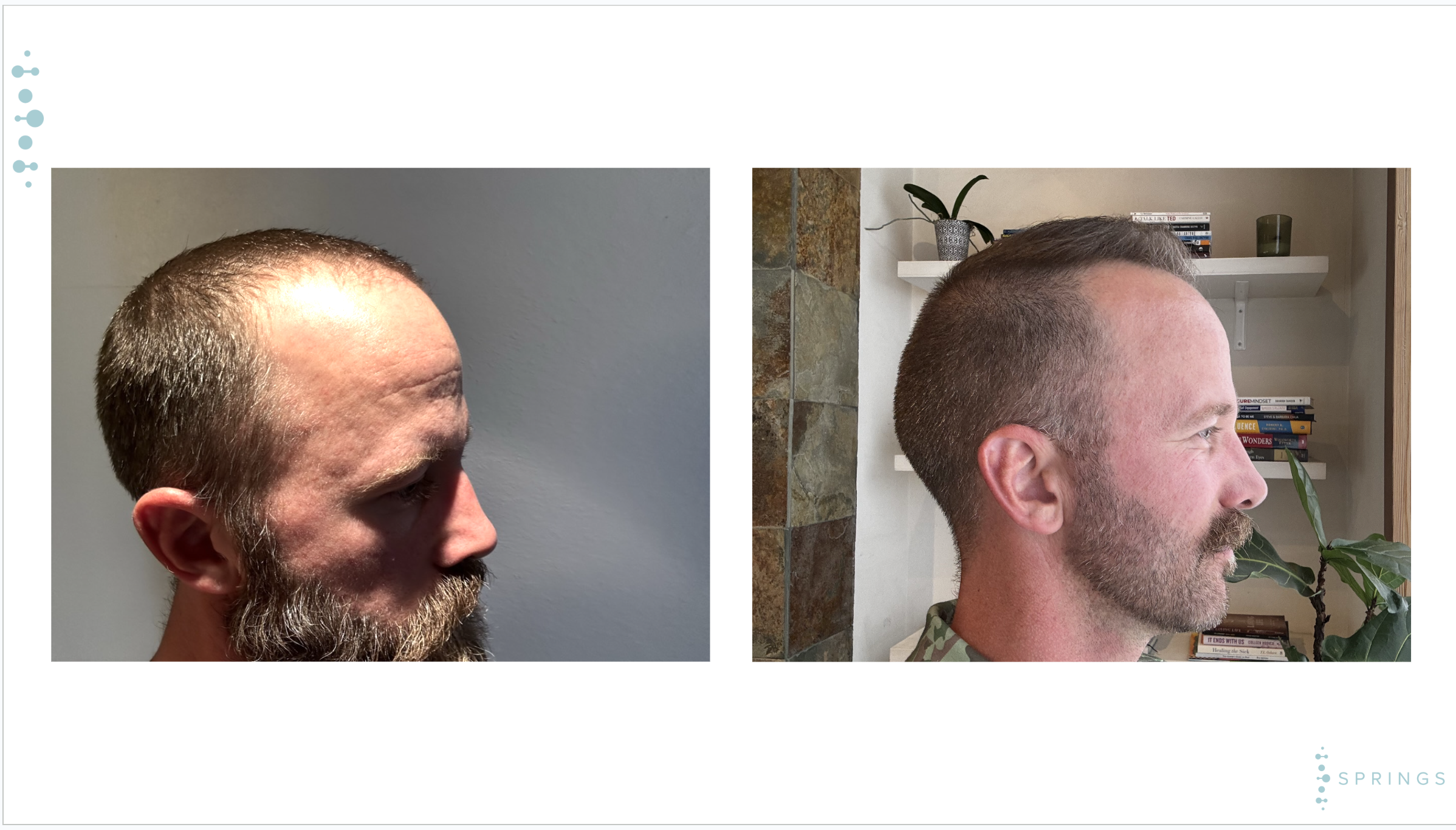 Before and After Results